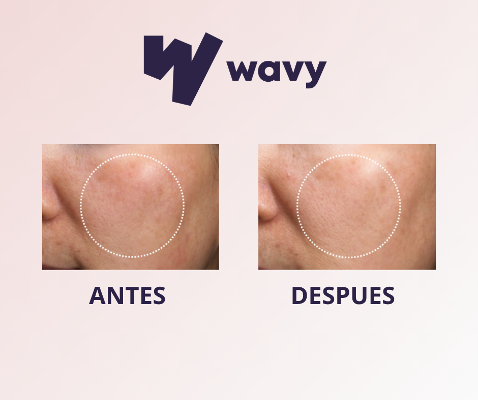 Wavy™ - Sérums para Cuidado Facial.